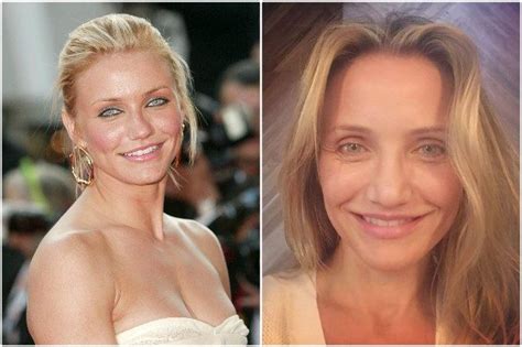 cameron diaz oggi malattia